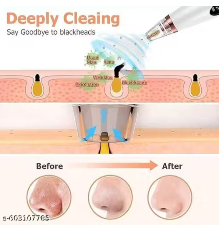 Multi-Functional Electric Blackhead Remover Vacuum β Deep Pore Cleaner & Skin Rejuvenation Tool